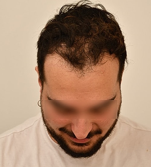 Man with dark hair looking downwards.