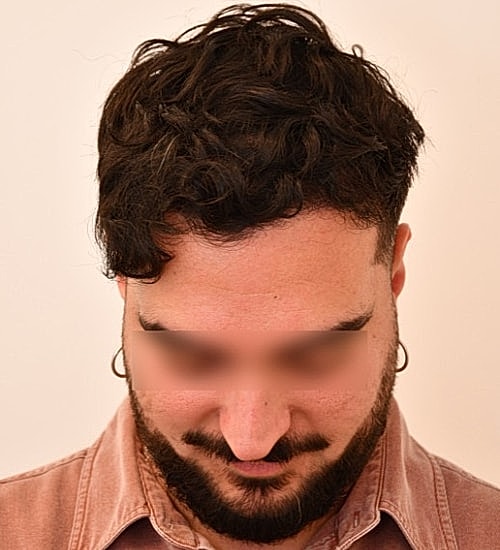 Man with curly hair looking down.