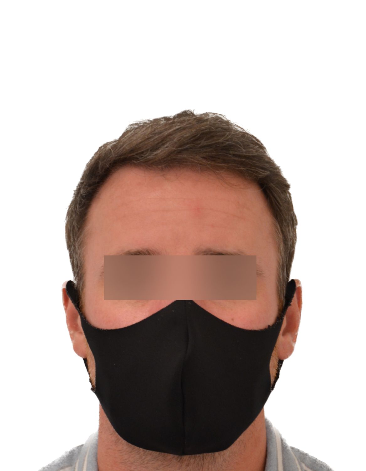 hair transplant after