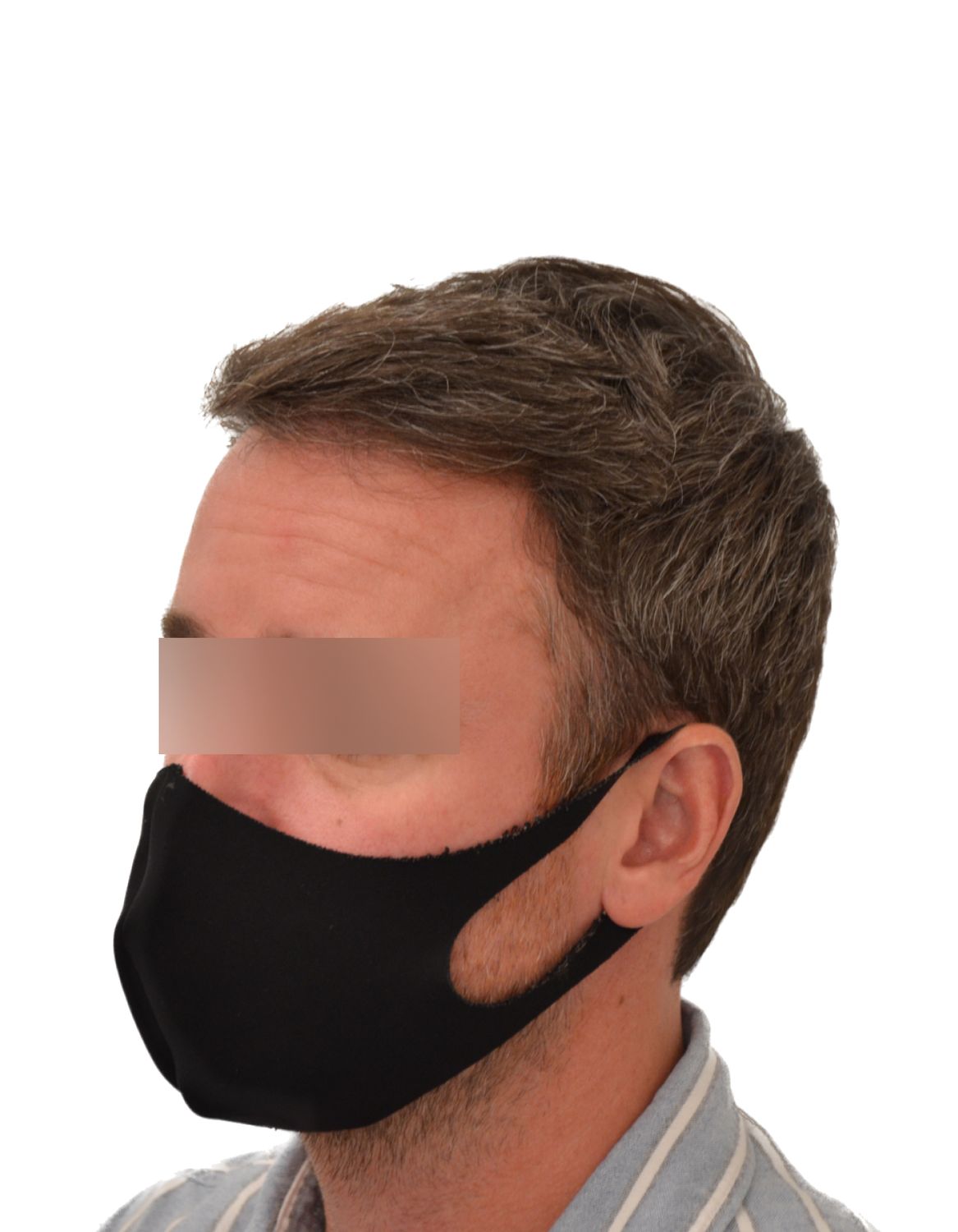 hair transplant after