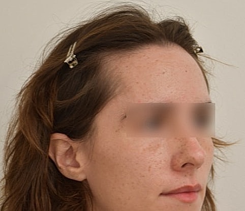 Profile of a woman with hair clips.