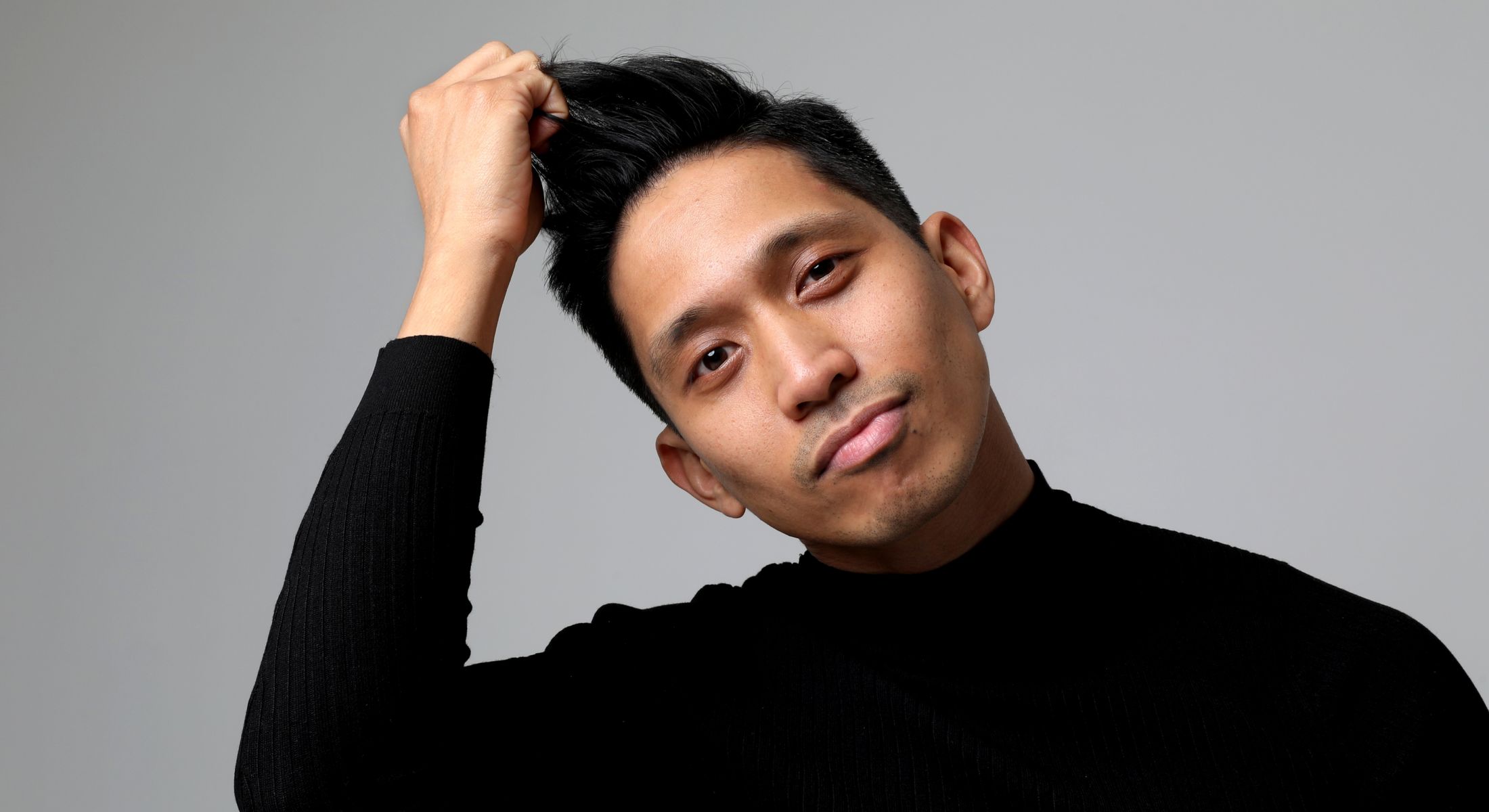 San Francisco hair transplant model wearing black shirt